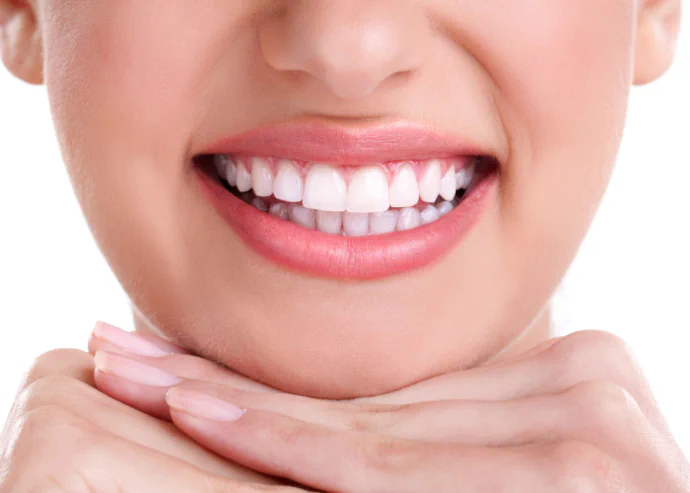 Smile Makeover